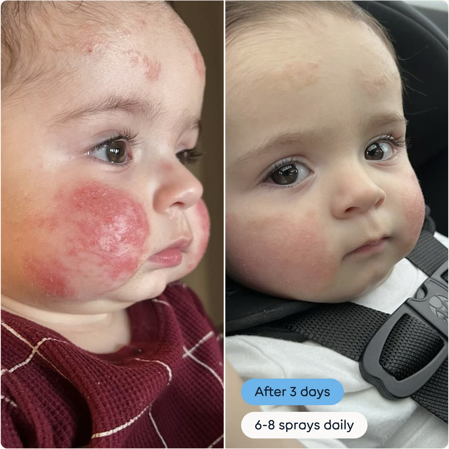 The Solution | Antimicrobial Skin Cleanser