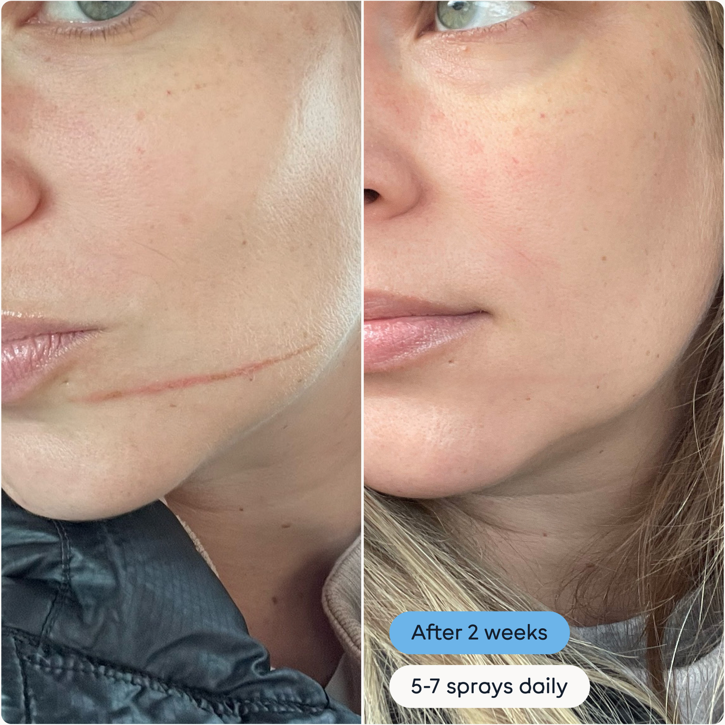 The Solution | Antimicrobial Skin Cleanser
