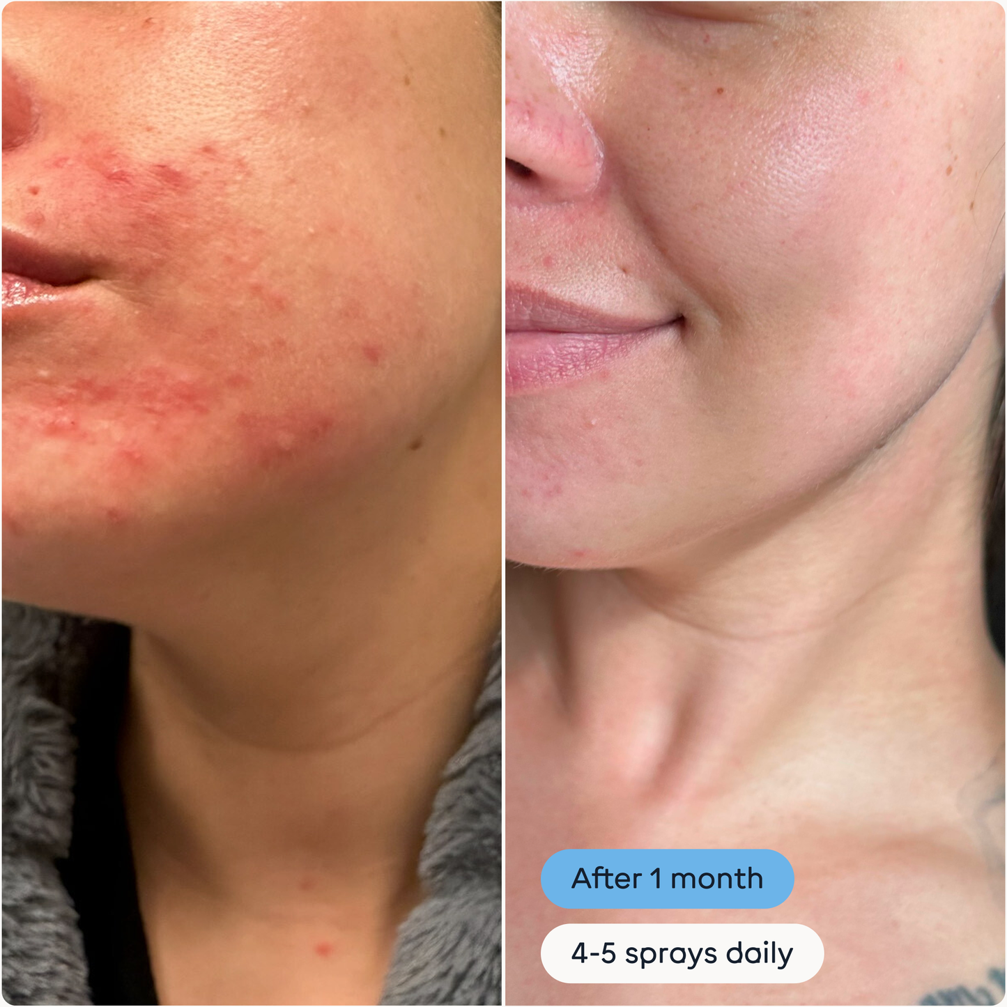 The Solution | Antimicrobial Skin Cleanser