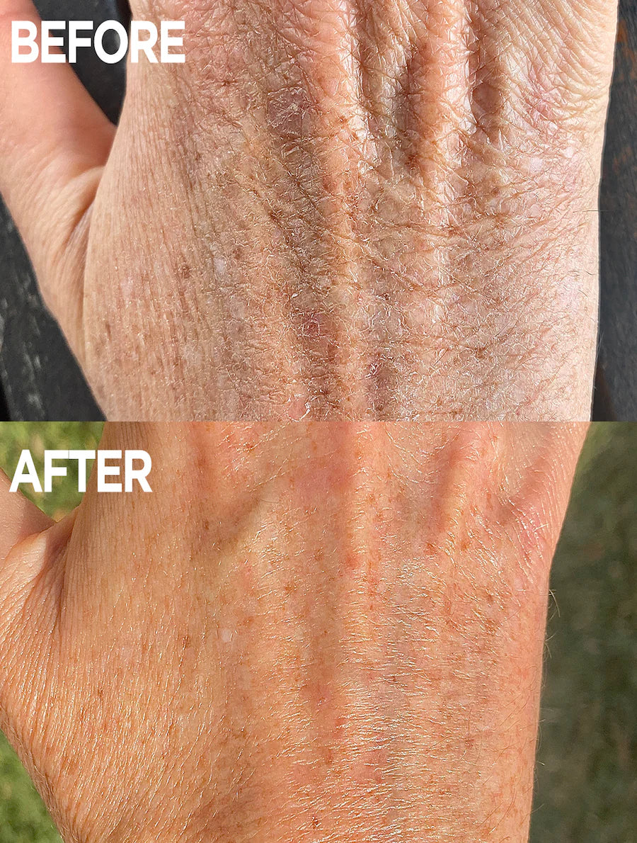 Golden Dry Skin | Miracle Salve